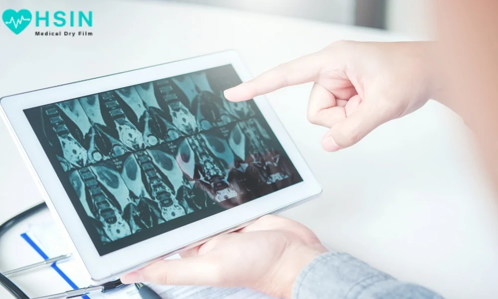 How Should Xray Film Be Stored Medical Facilities Guide HSIN FILM