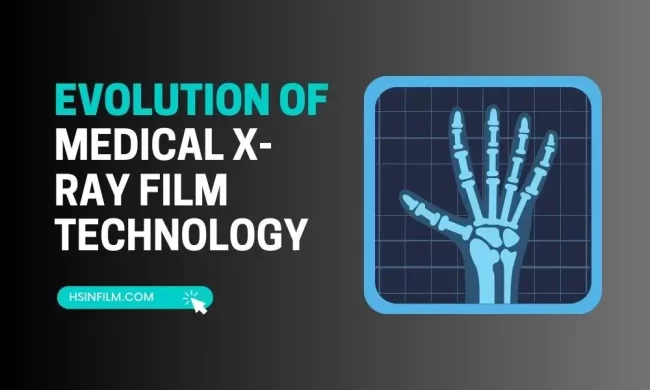 Evolution of Medical X-ray FIlm – HSIN