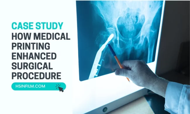 How Medical Printing Enhanced Surgical Procedure