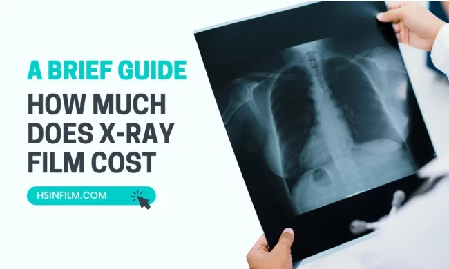 How Much Does X-Ray Film Cost