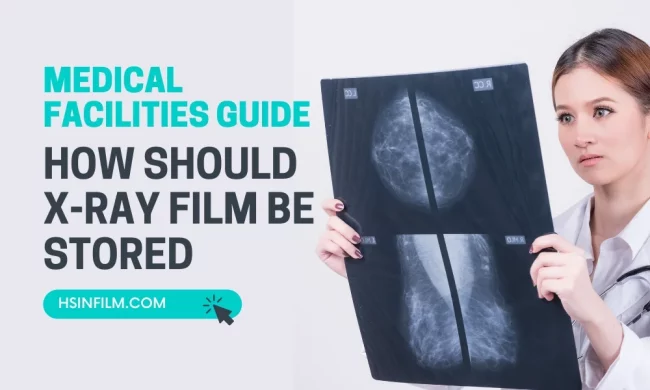 How Should X-ray Film Be Stored