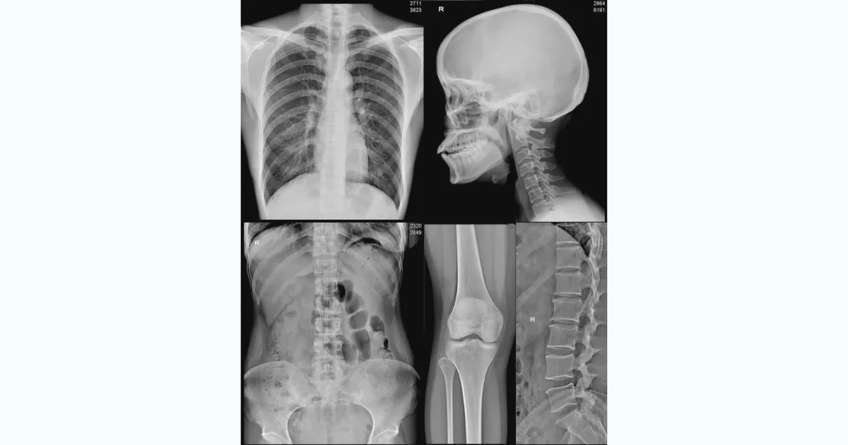 Science Behind Medical Thermal Film