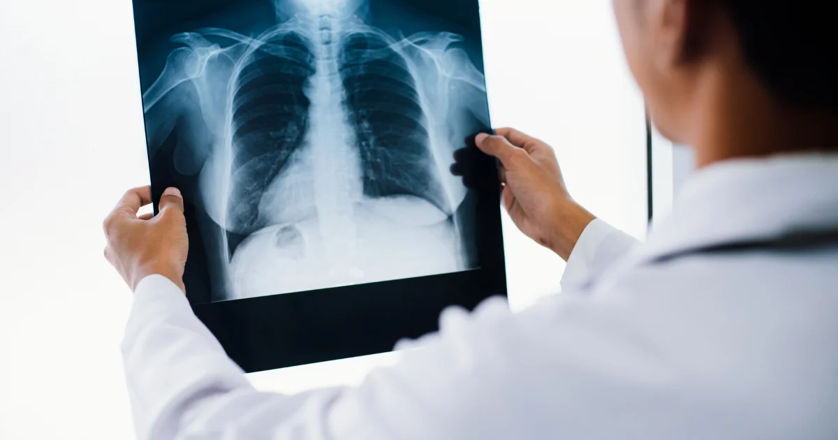 Types and Applications of Medical X-Ray Films