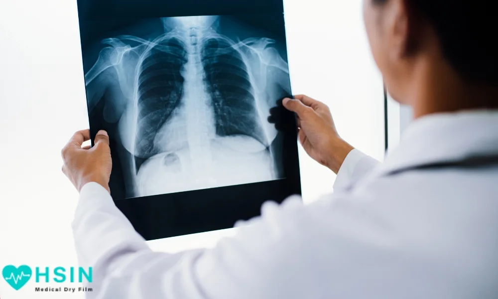 Types and Applications of Medical X-Ray Films - HSIN Film