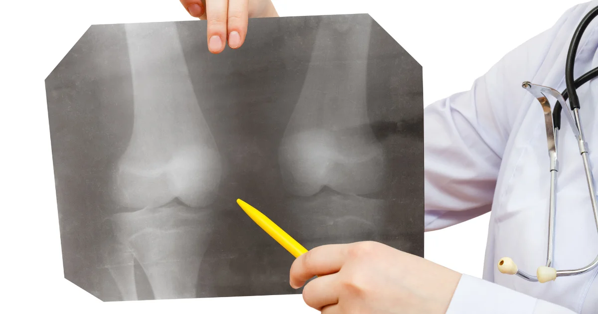 Laser Film and Orthopedics - HSIN Film