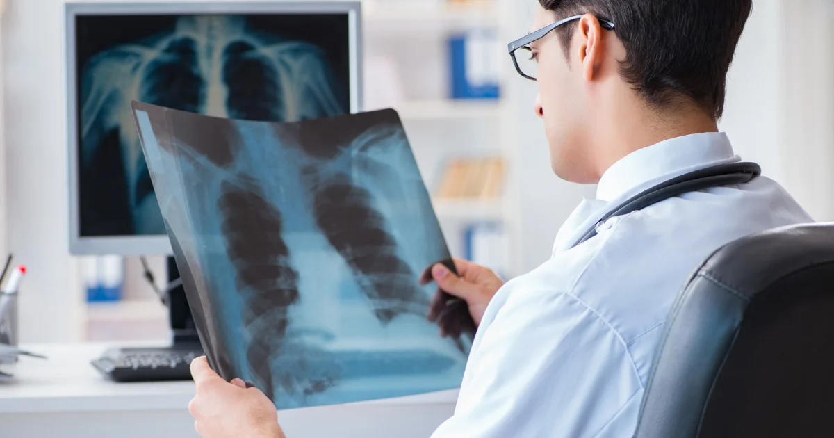 Process of capturing Images with Medical thermal Film