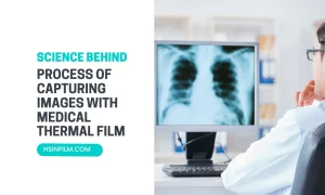 How Medical Thermal Film Capture Precise Images - HSIN Film