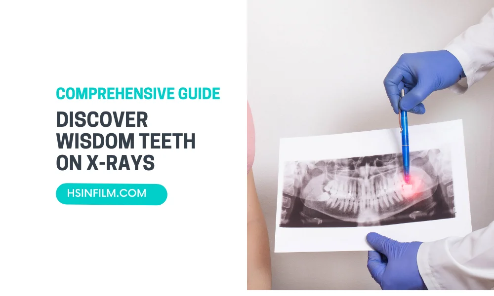Discover Wisdom Teeth on X-Rays - HSIN Film