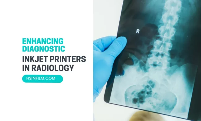 Inkjet Printers in Radiology – HSIN Film Inkjet Printers in Radiology - HSIN Film