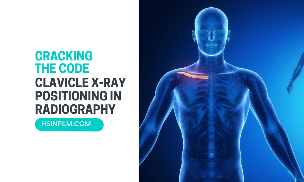 Clavicle X-ray Positioning in Radiography: Cracking the Code - HSIN FILM