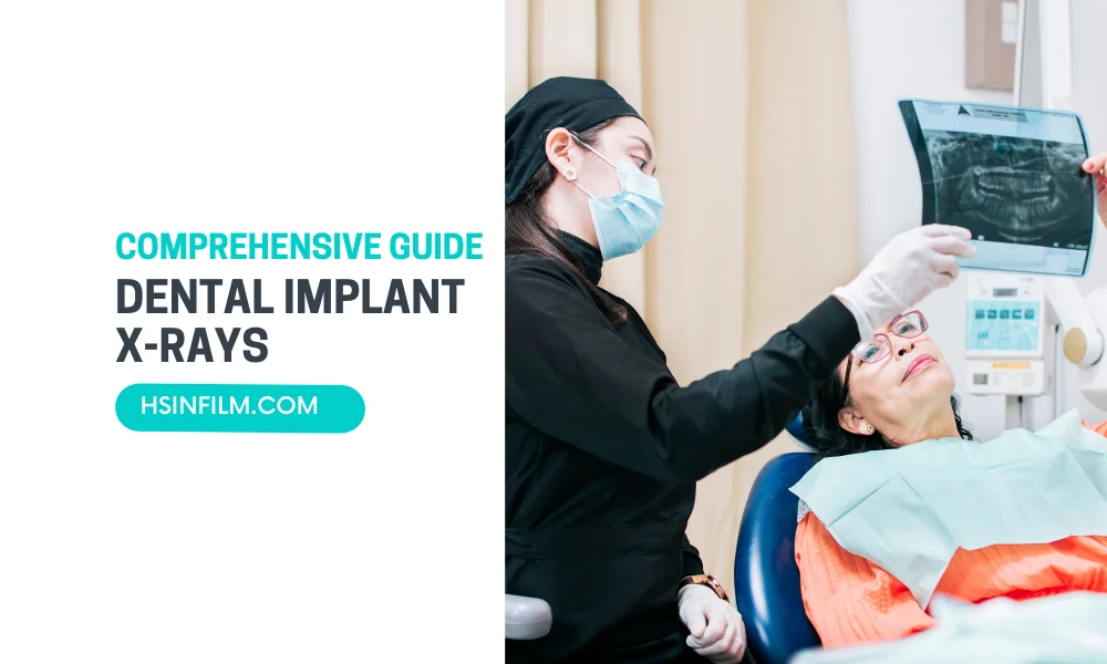 Dental Implant X-rays - HSIN Film