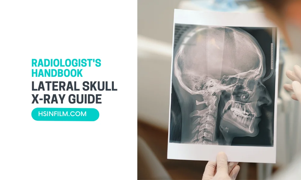 Lateral Skull X-ray Guide - HSIN Film