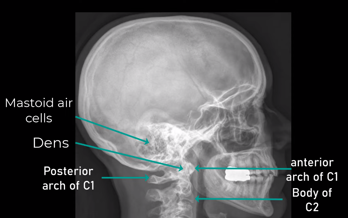 Lateral Skull X-ray Guide: Radiologist's Handbook - HSIN FILM