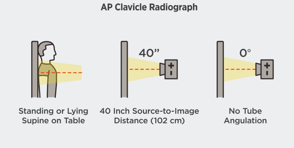 Clavicle X-ray Positioning AP View
