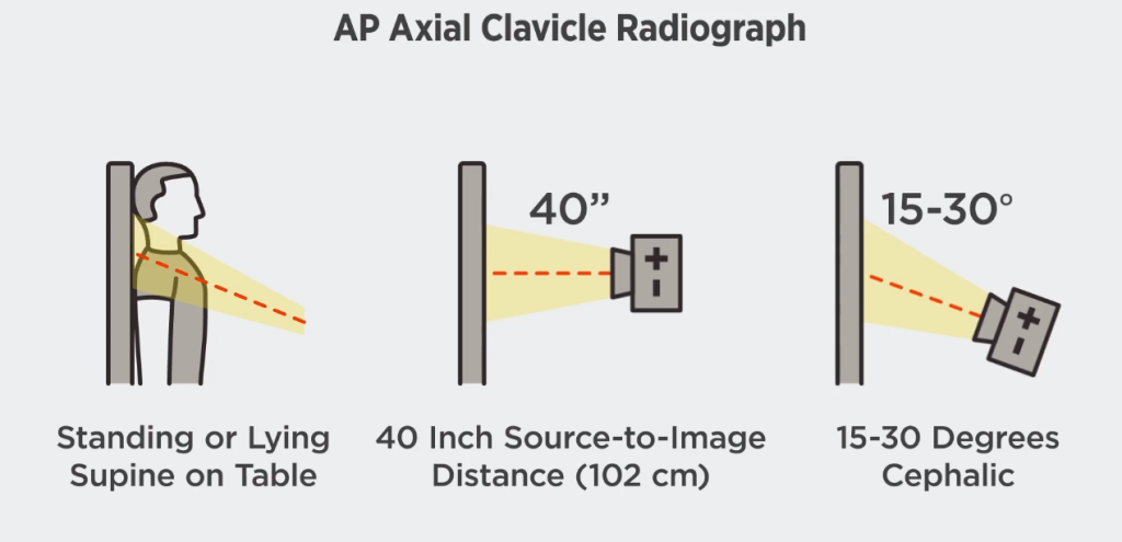 Clavicle X-ray Positioning AP Axial View