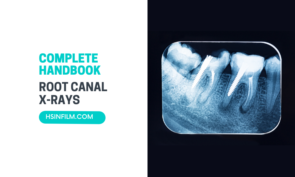 A Comprehensive Guide Through Root Canal X-rays - HSIN FILM