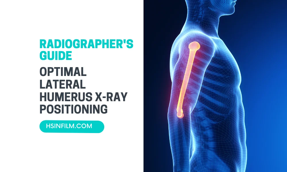 Optimal Lateral Humerus X-ray Positioning - HSIN Film