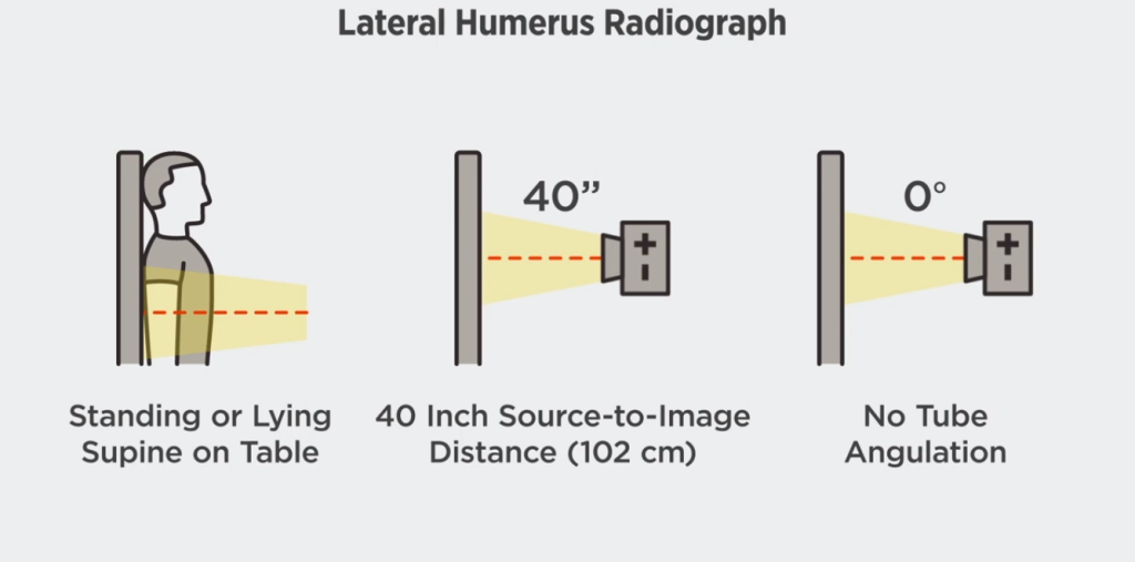 Lateral Humerus X-rays Positioning
