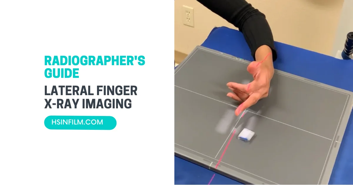 A Radiographer's Guide to Lateral Finger X-ray Imaging