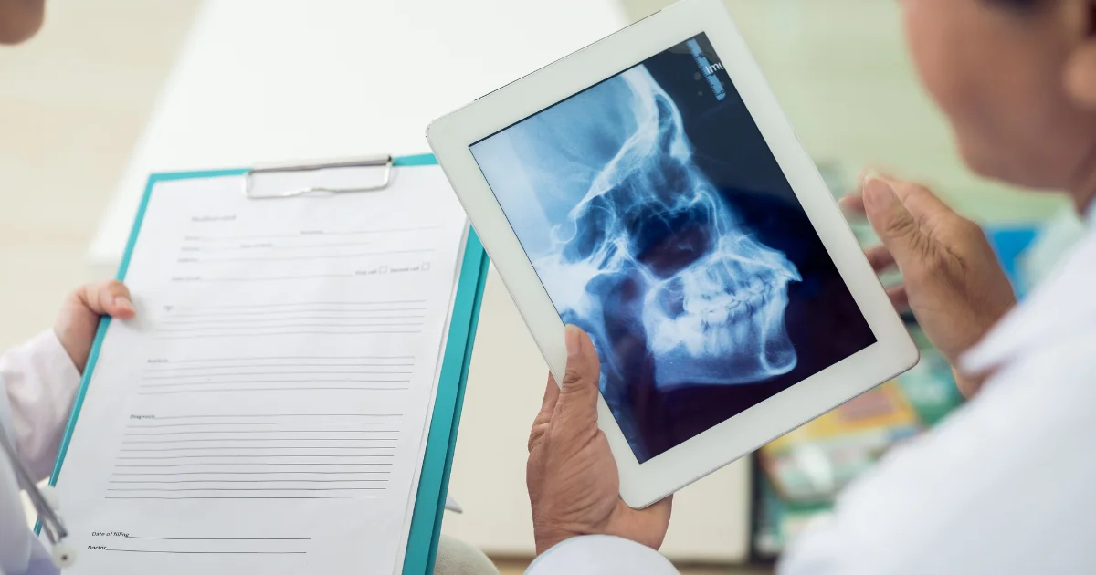 Understanding the Significance of Lateral Skull X-rays