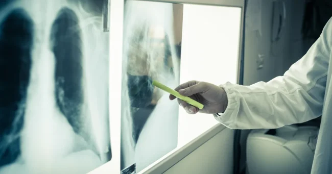 Artifacts on Medical Thermal Film Identification and Prevention Artifacts on Medical Thermal Film Identification and Prevention